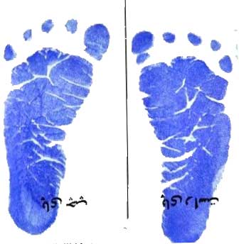 چرادر بیمارستان اثر کف پای نوزاد را میگیرند